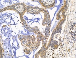 Invitrogen KChIP3 Polyclonal Antibody 100 &mu;L; Unconjugated:Antibodies,