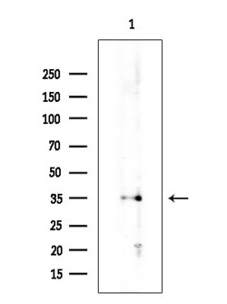 Invitrogen KChIP3 Polyclonal Antibody 100 &mu;L; Unconjugated:Antibodies,