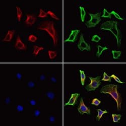 Invitrogen FAP Polyclonal Antibody 100 &mu;L; Unconjugated:Antibodies,