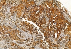 Invitrogen FAP Polyclonal Antibody 100 &mu;L; Unconjugated:Antibodies,
