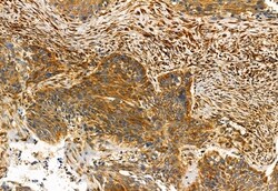 Invitrogen FAP Polyclonal Antibody 100 &mu;L; Unconjugated:Antibodies,