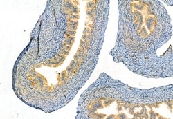 Invitrogen FAP Polyclonal Antibody 100 &mu;L; Unconjugated:Antibodies,