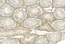 Invitrogen FAP Polyclonal Antibody 100 &mu;L; Unconjugated:Antibodies,