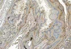 Invitrogen FAP Polyclonal Antibody 100 &mu;L; Unconjugated:Antibodies,