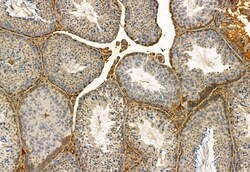 Invitrogen FAP Polyclonal Antibody 100 &mu;L; Unconjugated:Antibodies,