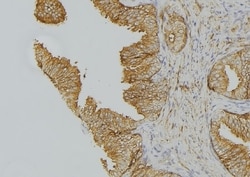 Invitrogen Cytokeratin 15 Polyclonal Antibody 100 &mu;L; Unconjugated:Antibodies,