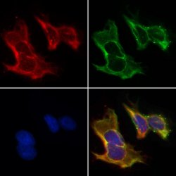 Invitrogen Cytokeratin 15 Polyclonal Antibody 100 &mu;L; Unconjugated:Antibodies,