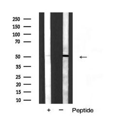 Invitrogen Cytokeratin 15 Polyclonal Antibody 100 &mu;L; Unconjugated:Antibodies,