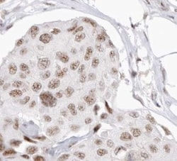 Invitrogen Cyclin F Polyclonal Antibody 100 &mu;L; Unconjugated:Antibodies,