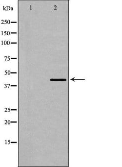 Invitrogen Dematin Polyclonal Antibody 100 &mu;L; Unconjugated:Antibodies,