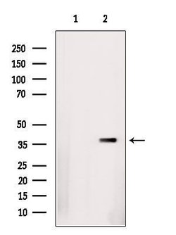 Invitrogen hnRNP D Polyclonal Antibody 100 &mu;L; Unconjugated:Antibodies,