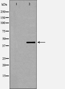 Invitrogen Phospho-Dematin (Ser403) Polyclonal Antibody 100 &mu;L; Unconjugated:Antibodies,