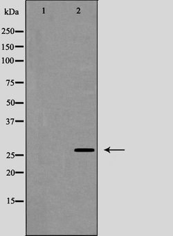 Invitrogen Phospho-Caveolin 2 (Tyr27) Polyclonal Antibody 100 &mu;L; Unconjugated:Antibodies,