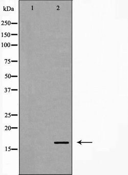 Invitrogen Phospho-Stathmin 1 (Ser25) Polyclonal Antibody 100 &mu;L; Unconjugated:Antibodies,