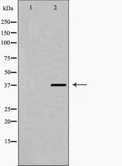 Invitrogen Phospho-hnRNP D (Ser83) Polyclonal Antibody 100 &mu;L; Unconjugated:Antibodies,