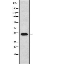 Invitrogen Phospho-Annexin A2 (Ser26) Polyclonal Antibody 100 &mu;L | Buy Online | Invitrogen&trade; | Fisher Scientific