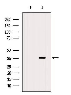 Invitrogen PSGR Polyclonal Antibody 100 &mu;L; Unconjugated:Antibodies,