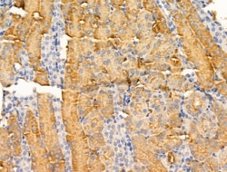 GLUT3 Polyclonal Antibody:Antibodies, Polyclonal