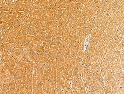 GLUT3 Polyclonal Antibody:Antibodies, Polyclonal