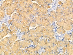 GLUT3 Polyclonal Antibody:Antibodies, Polyclonal