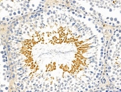 GLUT3 Polyclonal Antibody:Antibodies, Polyclonal