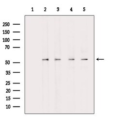 GLUT3 Polyclonal Antibody:Antibodies, Polyclonal