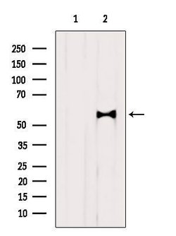 GLUT3 Polyclonal Antibody:Antibodies, Polyclonal