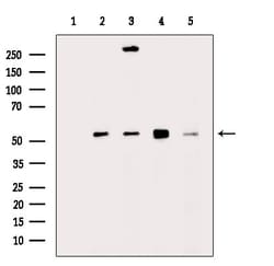 GLUT3 Polyclonal Antibody:Antibodies, Polyclonal