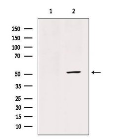 GLUT3 Polyclonal Antibody:Antibodies, Polyclonal