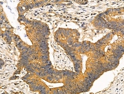 Invitrogen RhoH Polyclonal Antibody 100 &mu;L; Unconjugated:Antibodies,