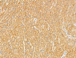 Invitrogen RhoH Polyclonal Antibody 100 &mu;L; Unconjugated:Antibodies,