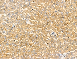 Invitrogen RhoH Polyclonal Antibody 100 &mu;L; Unconjugated:Antibodies,