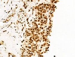Invitrogen Ku70/Ku80 Polyclonal Antibody 100 &mu;L; Unconjugated:Antibodies,