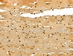 Invitrogen Ku70/Ku80 Polyclonal Antibody 100 &mu;L; Unconjugated:Antibodies,