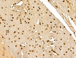 Invitrogen Ku70/Ku80 Polyclonal Antibody 100 &mu;L; Unconjugated:Antibodies,
