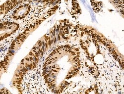Invitrogen Ku70/Ku80 Polyclonal Antibody 100 &mu;L; Unconjugated:Antibodies,