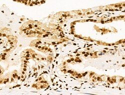 Invitrogen Ku70/Ku80 Polyclonal Antibody 100 &mu;L; Unconjugated:Antibodies,