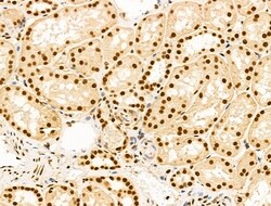 Invitrogen Ku70/Ku80 Polyclonal Antibody 100 &mu;L; Unconjugated:Antibodies,