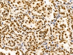 Invitrogen Ku70/Ku80 Polyclonal Antibody 100 &mu;L; Unconjugated:Antibodies,