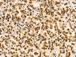 Invitrogen Ku70/Ku80 Polyclonal Antibody 100 &mu;L; Unconjugated:Antibodies,