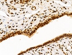 Invitrogen Ku70/Ku80 Polyclonal Antibody 100 &mu;L; Unconjugated:Antibodies,