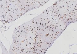 Invitrogen Ku70/Ku80 Polyclonal Antibody 100 &mu;L; Unconjugated:Antibodies,