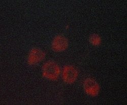 CDKN2B Polyclonal Antibody:Antibodies, Polyclonal