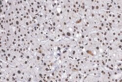 CDKN2B Polyclonal Antibody:Antibodies, Polyclonal