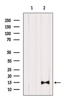 CDKN2B Polyclonal Antibody:Antibodies, Polyclonal