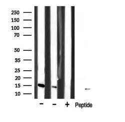 CDKN2B Polyclonal Antibody:Antibodies, Polyclonal