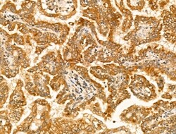 Invitrogen Tyrosinase Polyclonal Antibody 100 &mu;L; Unconjugated:Antibodies,