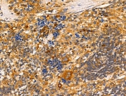Invitrogen Tyrosinase Polyclonal Antibody 100 &mu;L; Unconjugated:Antibodies,