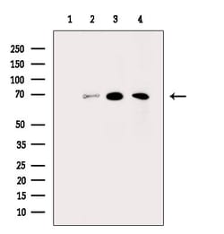 Invitrogen Tyrosinase Polyclonal Antibody 100 &mu;L; Unconjugated:Antibodies,