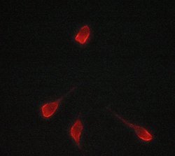 Invitrogen Tyrosinase Polyclonal Antibody 100 &mu;L; Unconjugated:Antibodies,